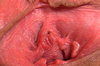 Free Gape My Pussy Trial s0